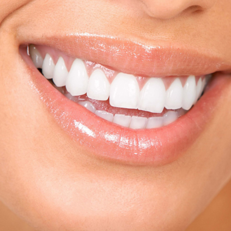 اسنانك اكثر بياضا مع الملح