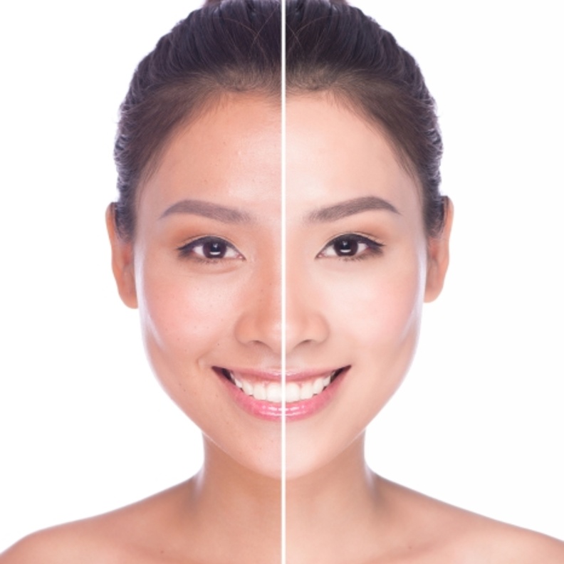 ماسك الزبادي يزيل اسمرار البشرة جراء الشمس