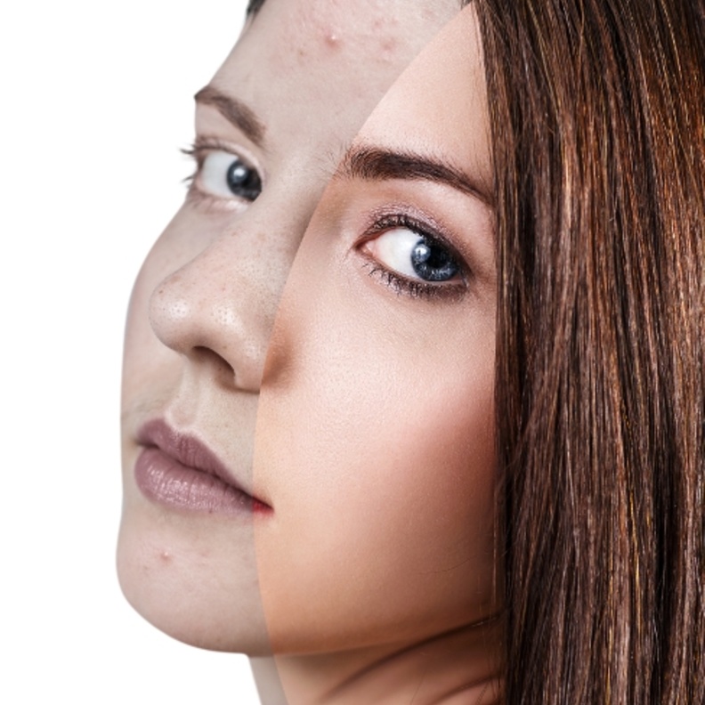 السدر لحب الشباب