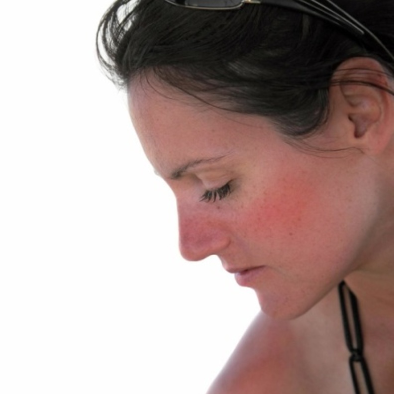 بشرة متضررة من اشعة الشمس