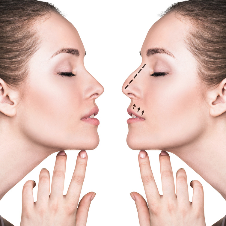 كيف تتم عملية تنحيف وتصغير الأنف وأهم نتائجها