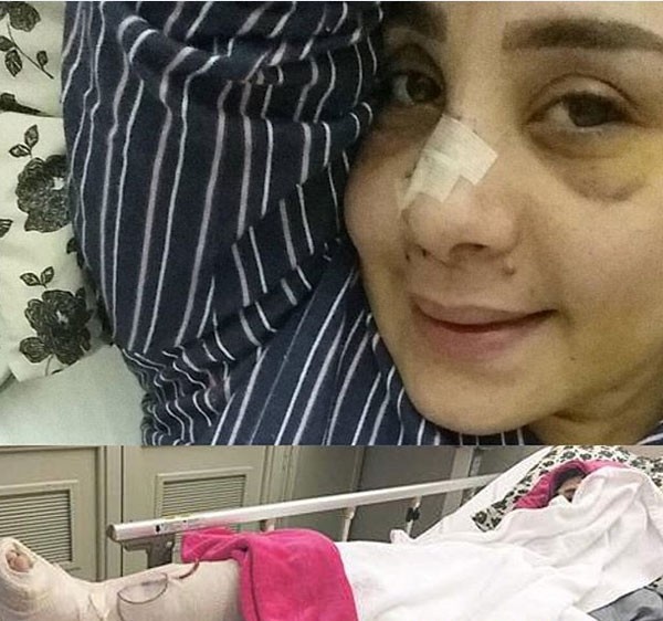 الفنانة شوق اصيبت سابقا بتشوه في انفها بسبب حادث اليم