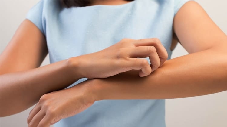 الكورتيزون علاج للالتهابات الجلدية