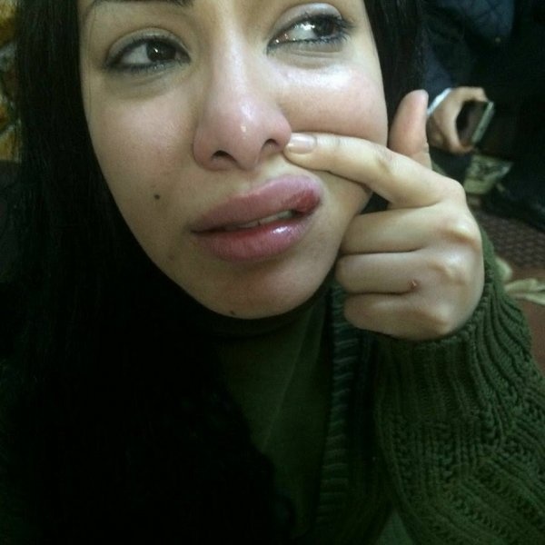 أثار الاعتداء على ميريهان حسين 